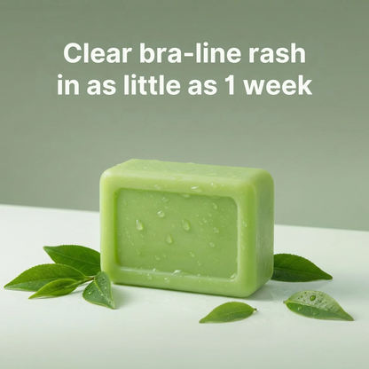 The Royce Derm AntiFungal Relief Soap Bar